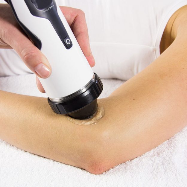 Stosswellenbehandlung am Armgelenk mittels Stosswellengerät